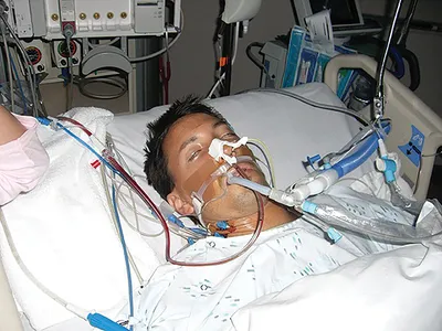 Man on a ventilator in a hospital ICU bed surrounded by medical equipment and tubes