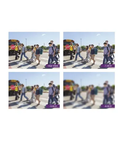 Four-panel comparison showing children crossing a street from sharp to increasingly blurred vision